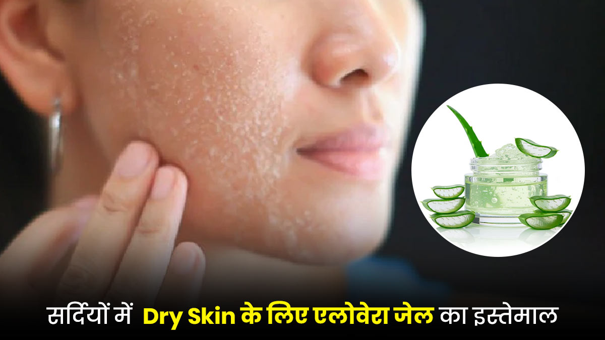 Winter Dry Skin Care: सर्दियों में Dry Skin का बेस्ट इलाज है एलोवेरा जेल, जानें इस्तेमाल का सही तरीका