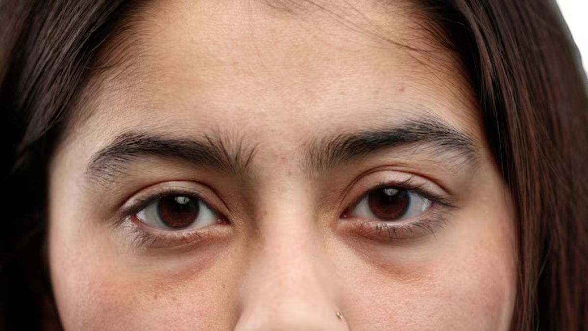 सर्दियों में क्यों बढ़ जाते हैं Dark Circles? थकान नहीं, कुछ और हैं असली वजहें