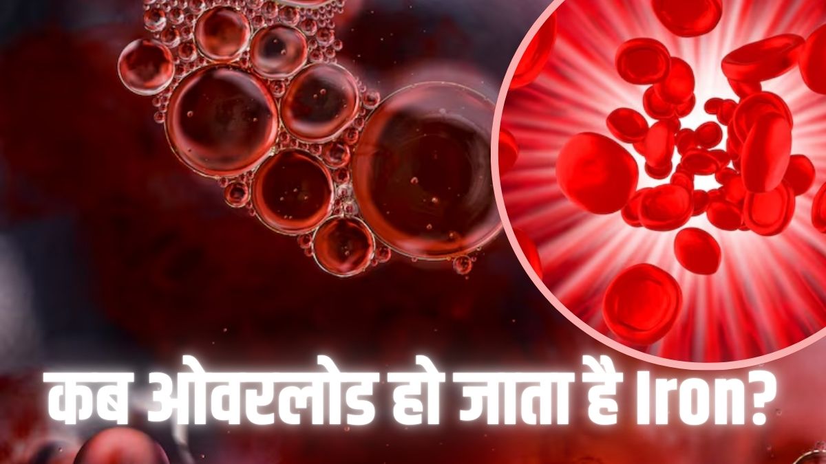 Iron Deficiency ही नहीं, ओवरलोड भी है जानलेवा! इन अंगों को पहुंचता है नुकसान; डॉक्‍टर ने बताया