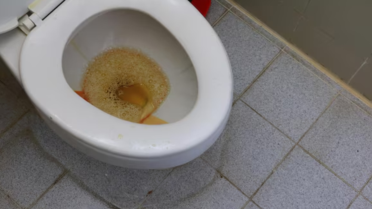 onion peel toilet cleaning