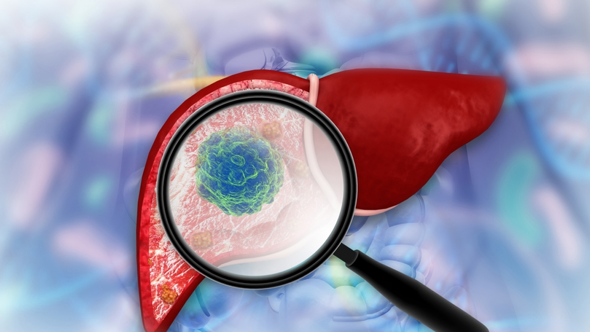 can sugary drink harm liver health