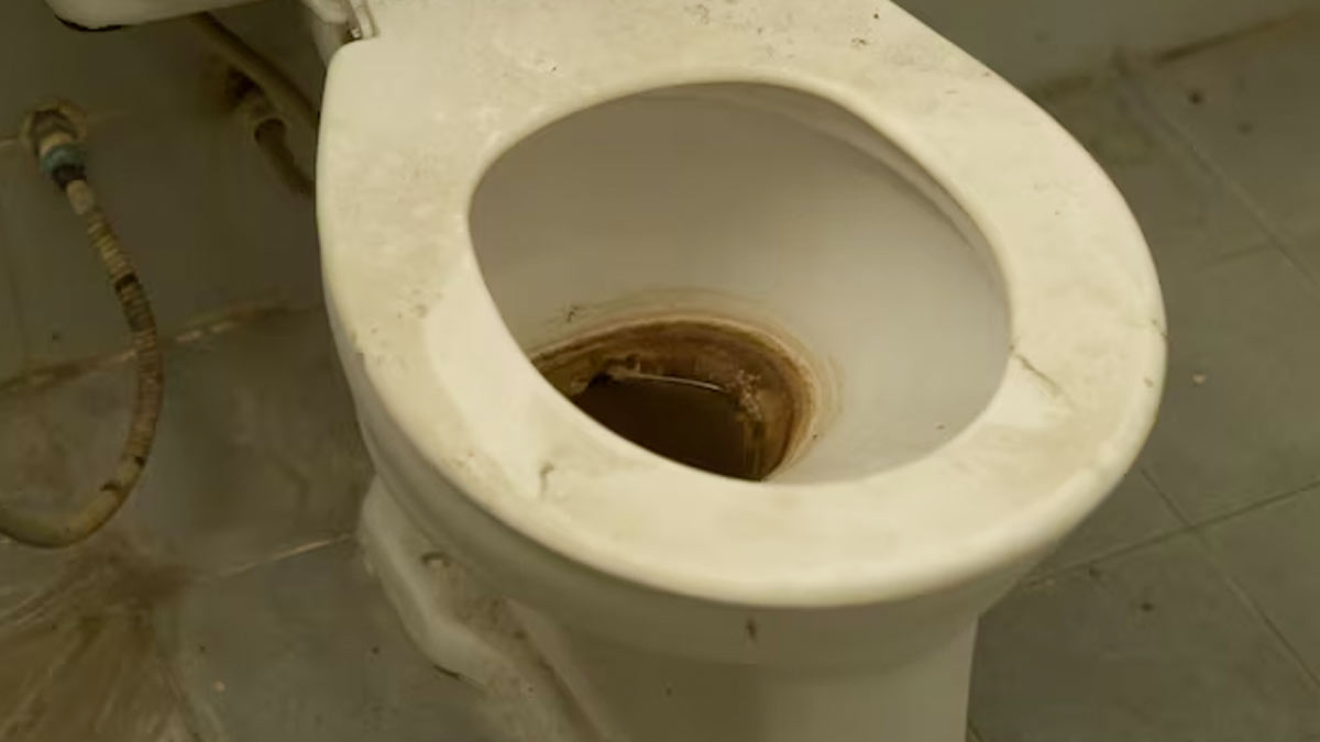 toilet seat yellow stain remover hacks