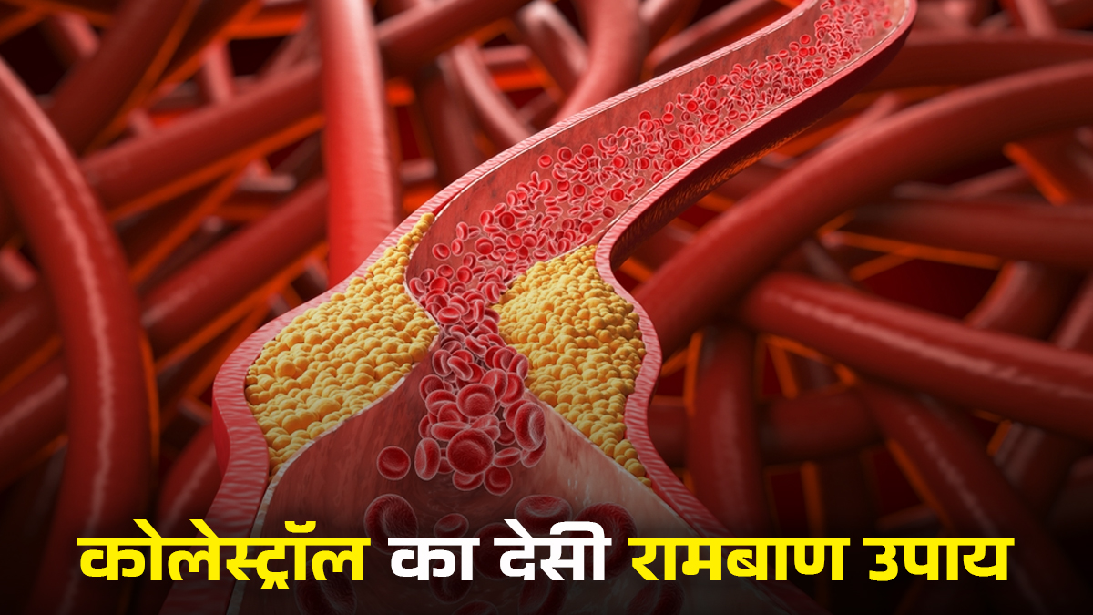 High Cholesterol Home Remedy: नसों की सफाई का सबसे पुराना और शक्तिशाली देसी रामबाण उपाय