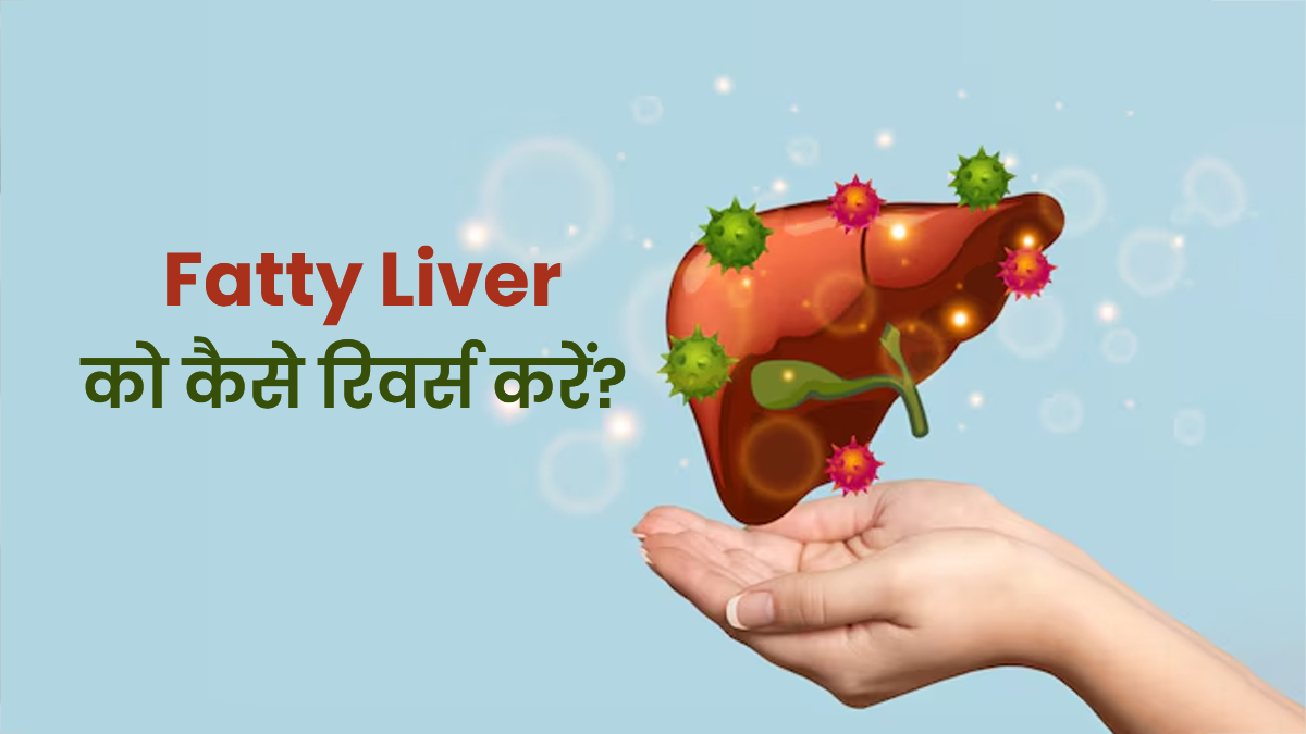 Fatty Liver को रिवर्स करने के लिए करें ये 5 काम, लिवर पर जमी चर्बी होगी कम