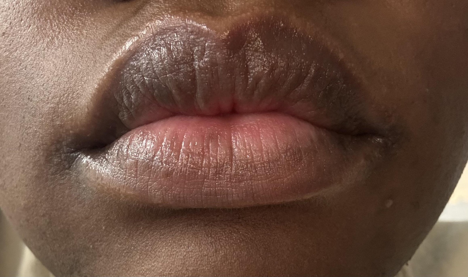 dark lips to pink lips