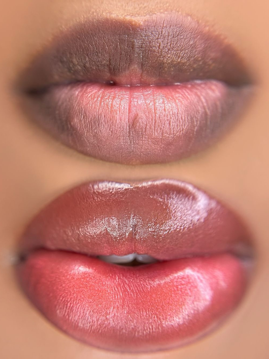 permanent pink lips solution