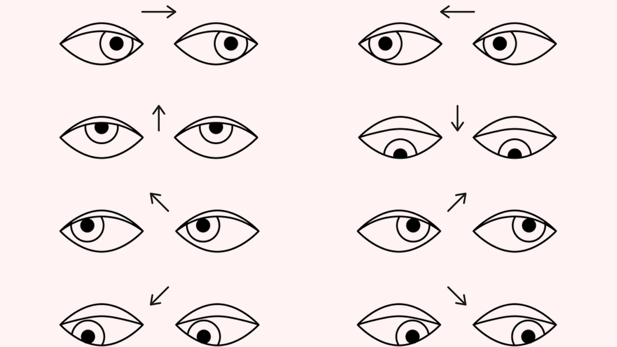 excessive screen time affect your eyes