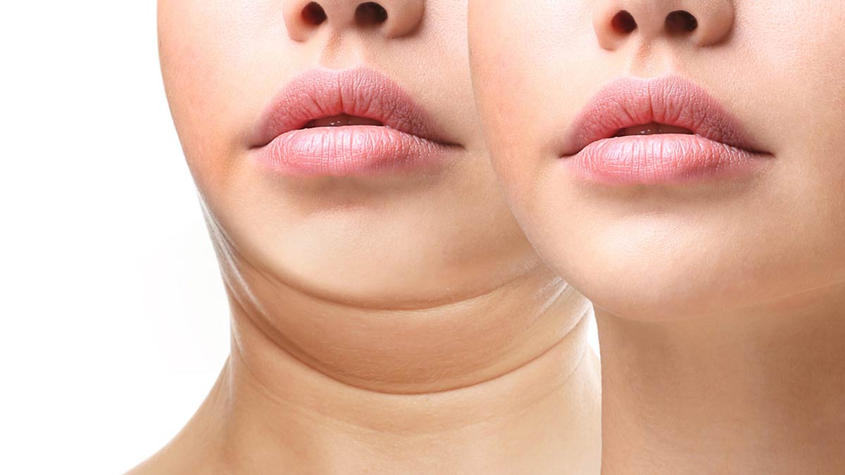 face fat reducing easy exercises