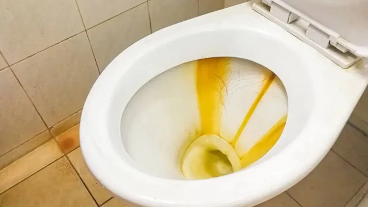 toilet seat cleaning