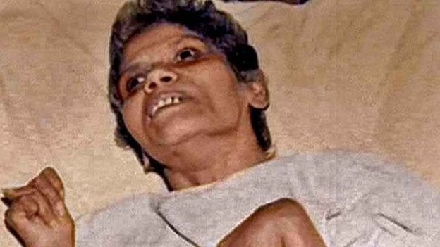 Aruna Shanbaug case