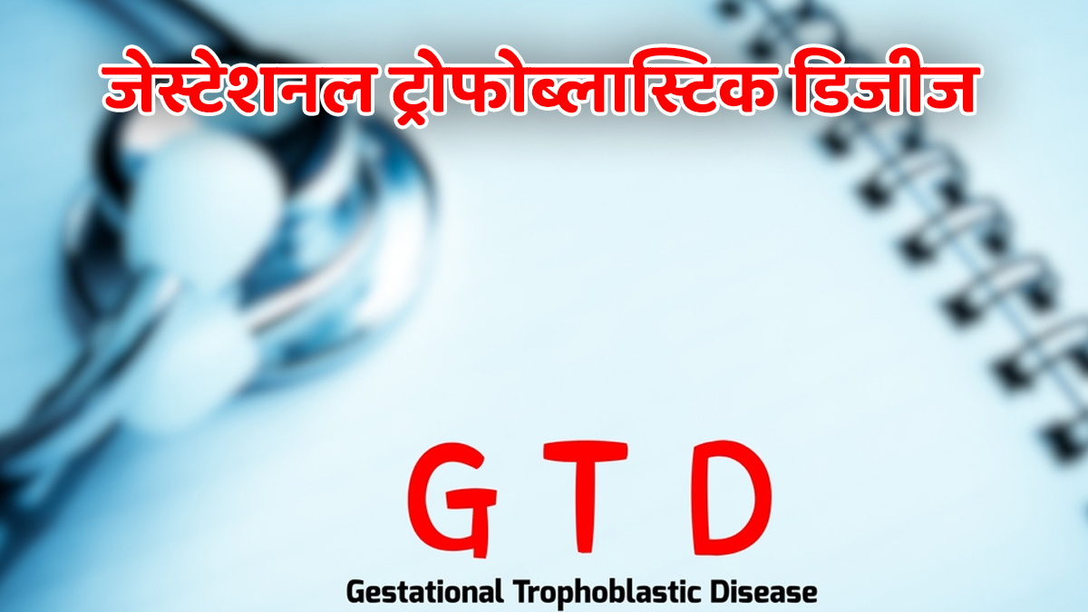 Gestational Trophoblastic Disease