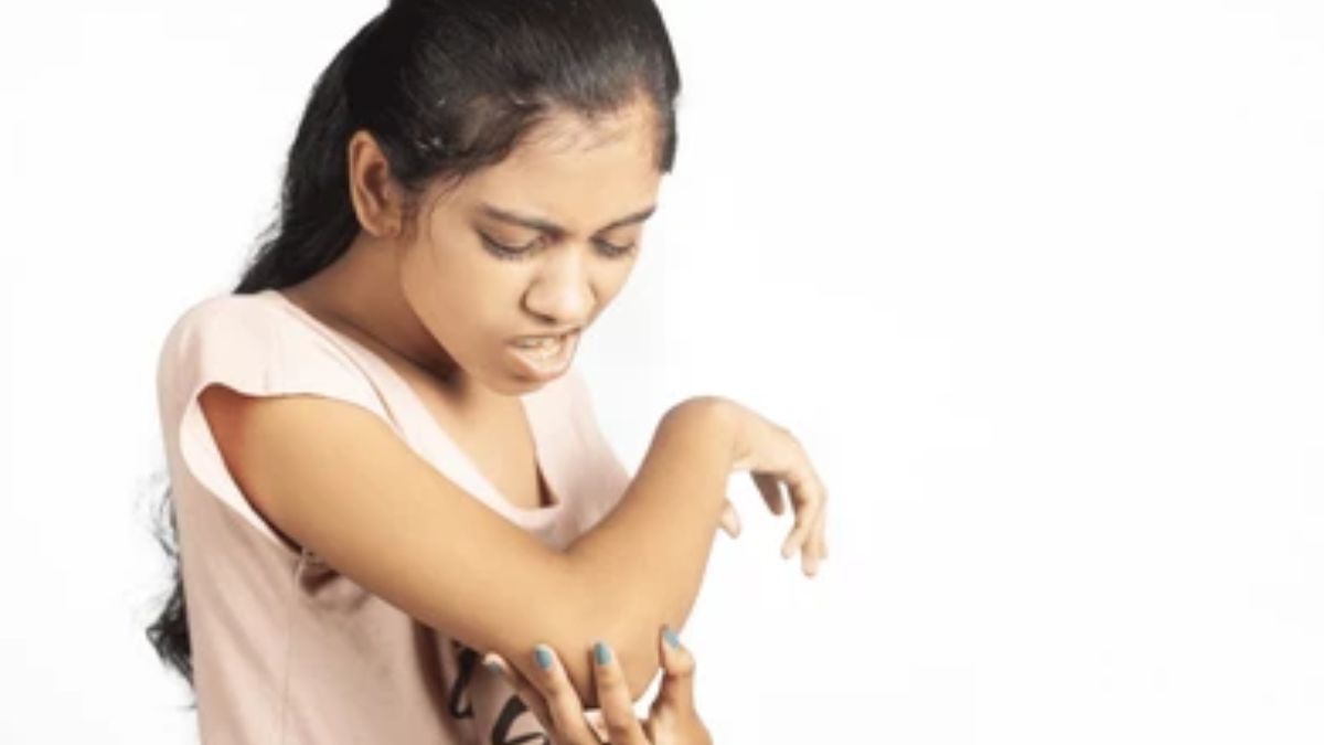 dark elbows remedy (2)