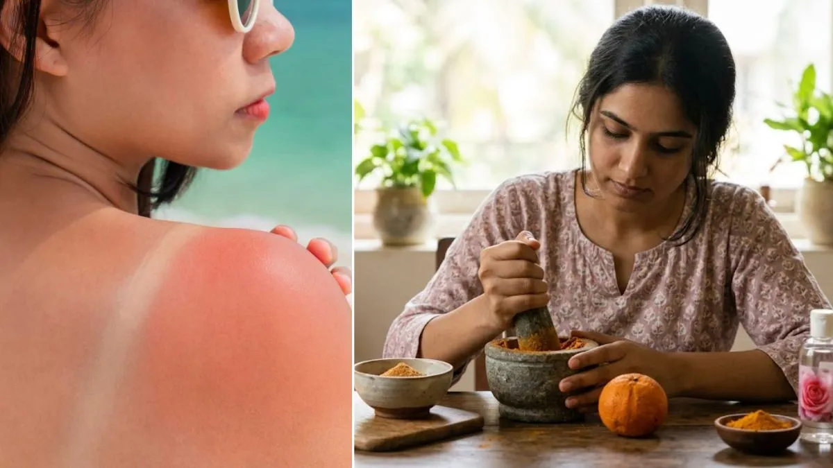 sun tan removal tips