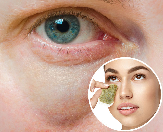 homemade eye patches