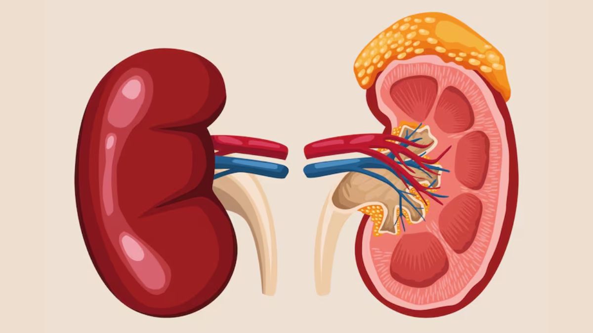 kidney stone risk (2)