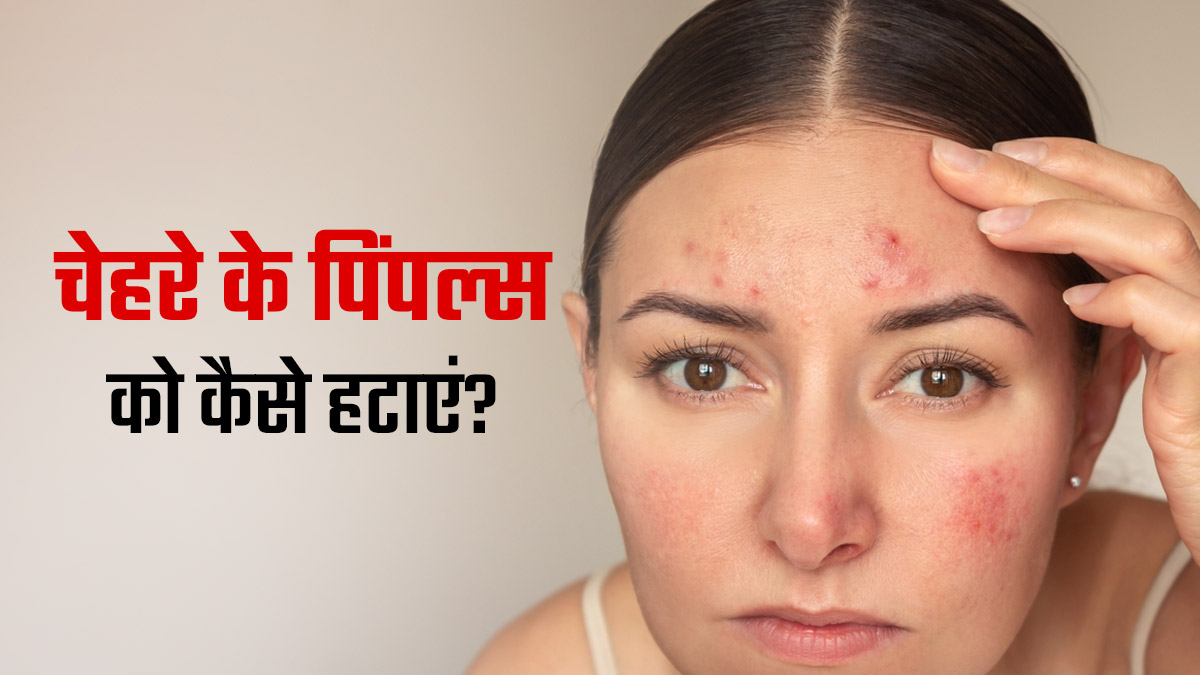 सिर्फ 3 चीजों से बने फेस पैक से Red Pimples होंगे कम, 1 बार लगाकर जरूर देखें
