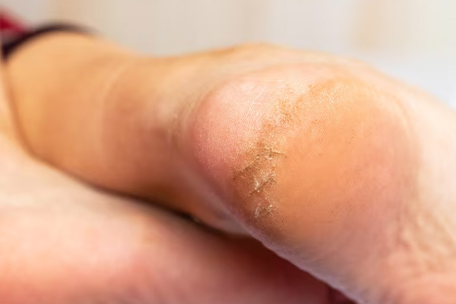 2 - 2026-04-17T151816.571