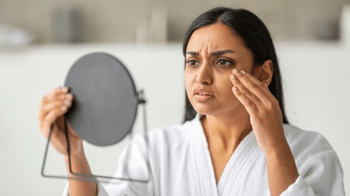 dry skin remedy (1)