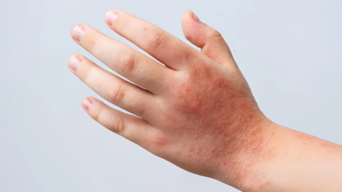 magnific harmful effects of dishwashing and laundry soap