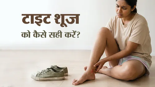 Shoe bite home remedies 