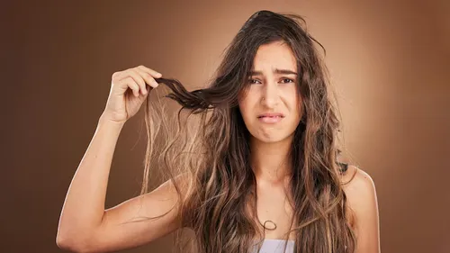 greasy hair problem