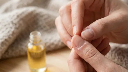 effective ways to treat peeling skin around nails