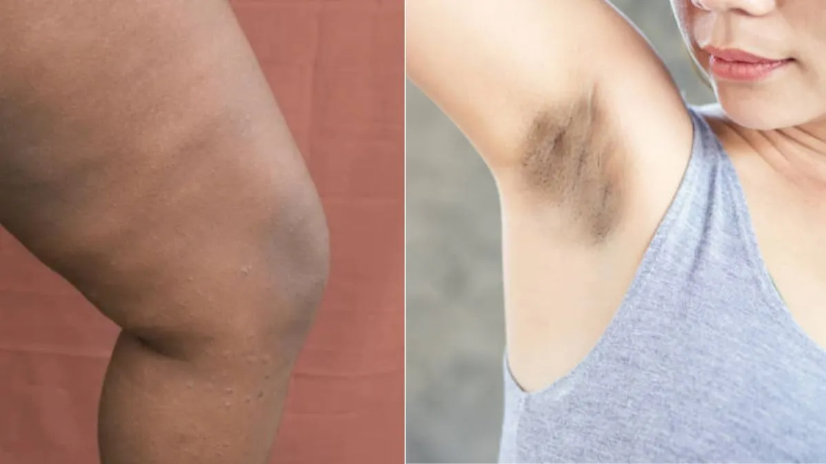 remove blackness of underarms and inner thighs with barley flour scrub (1)