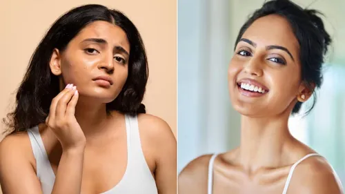 how to identify skin type