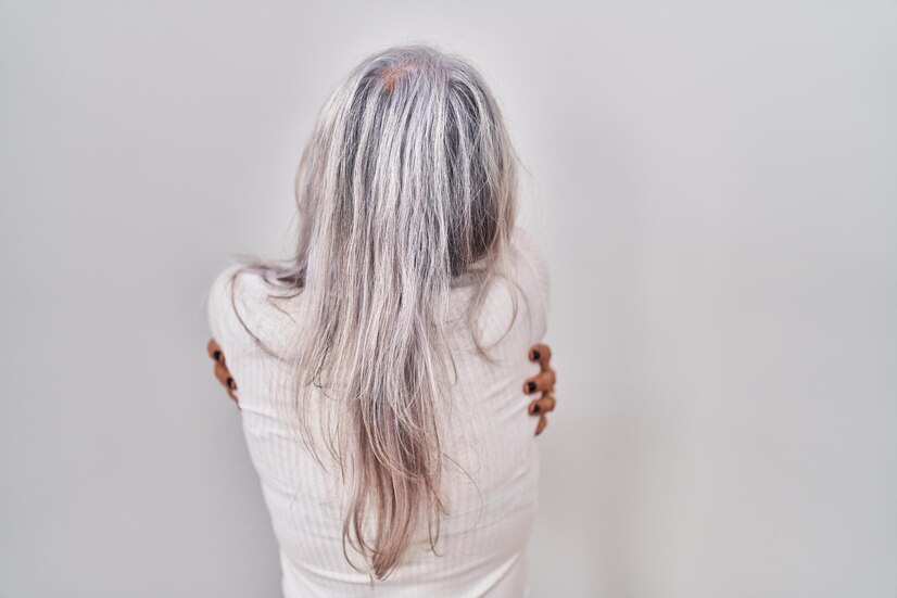 grey hair in young age