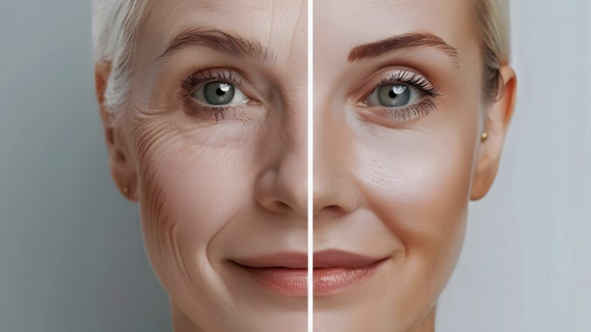 Remove-wrinkles-overnight