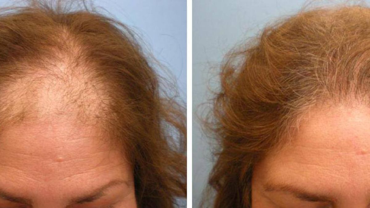 Untitled design - 2025-02-15T012547.580