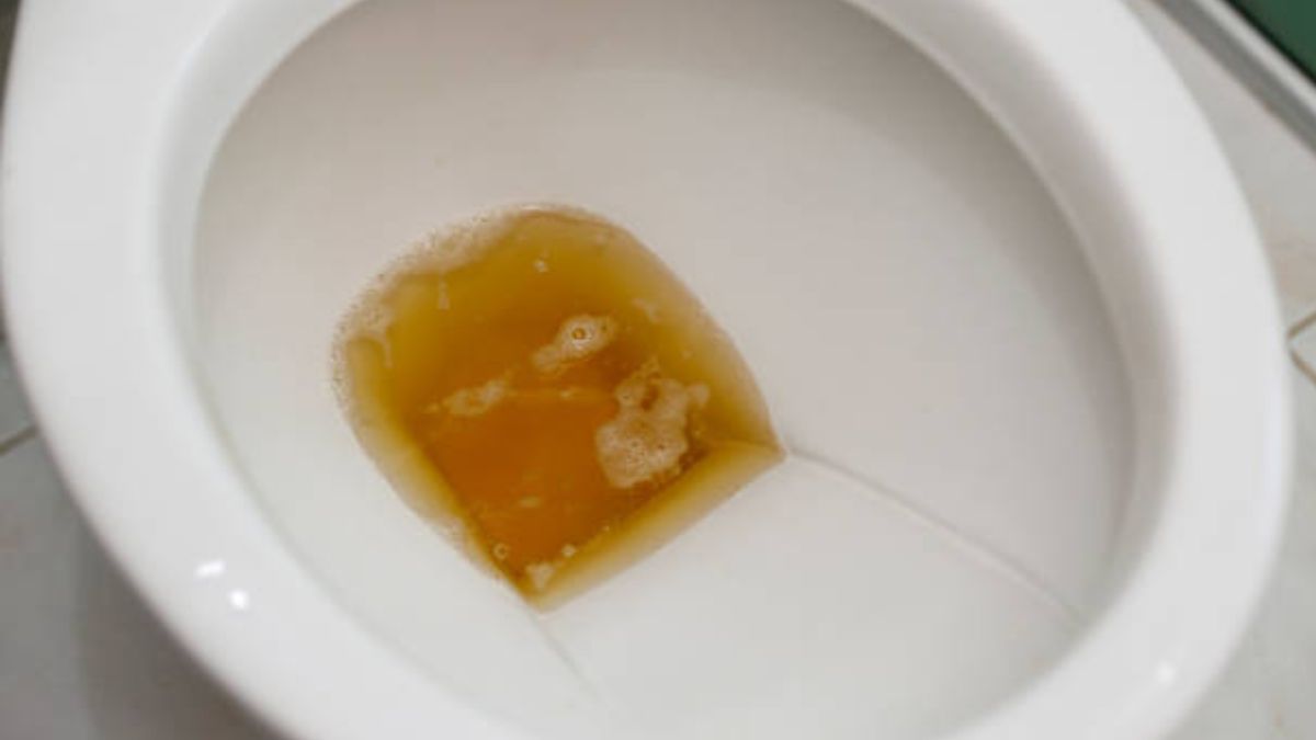 causes and home remedies for urine discoloration and foam in summer-3