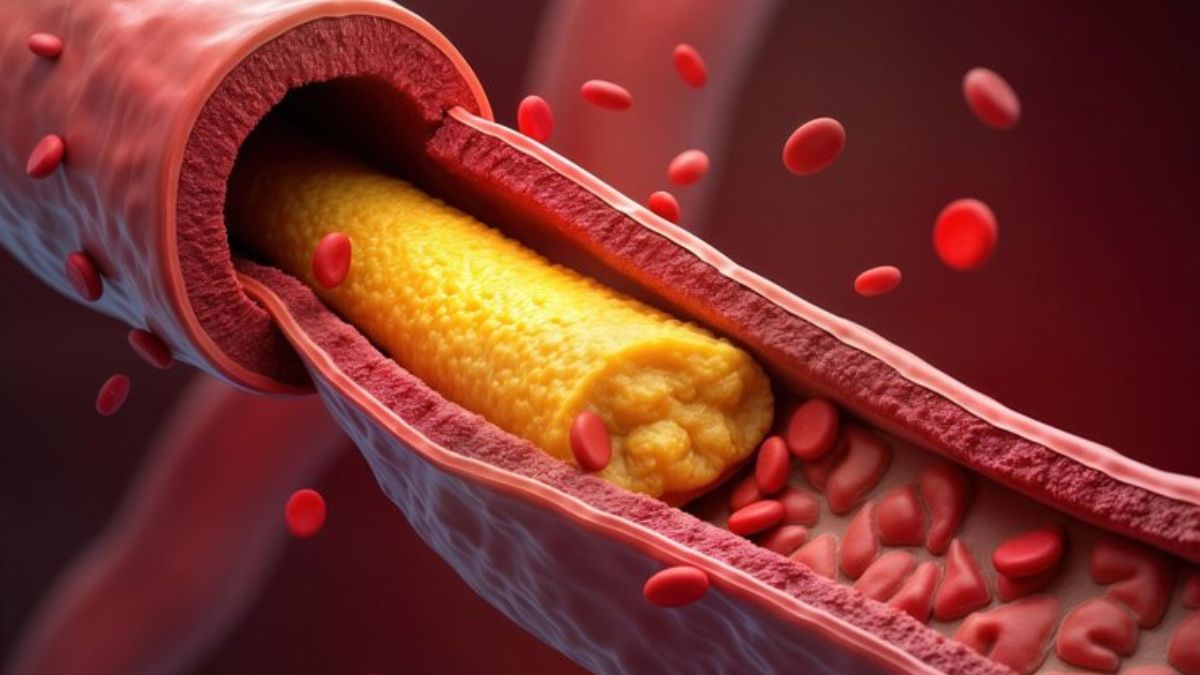 5 habits will increase body cholesterol in 24 hours what to do to prevent it  preventive measures-1