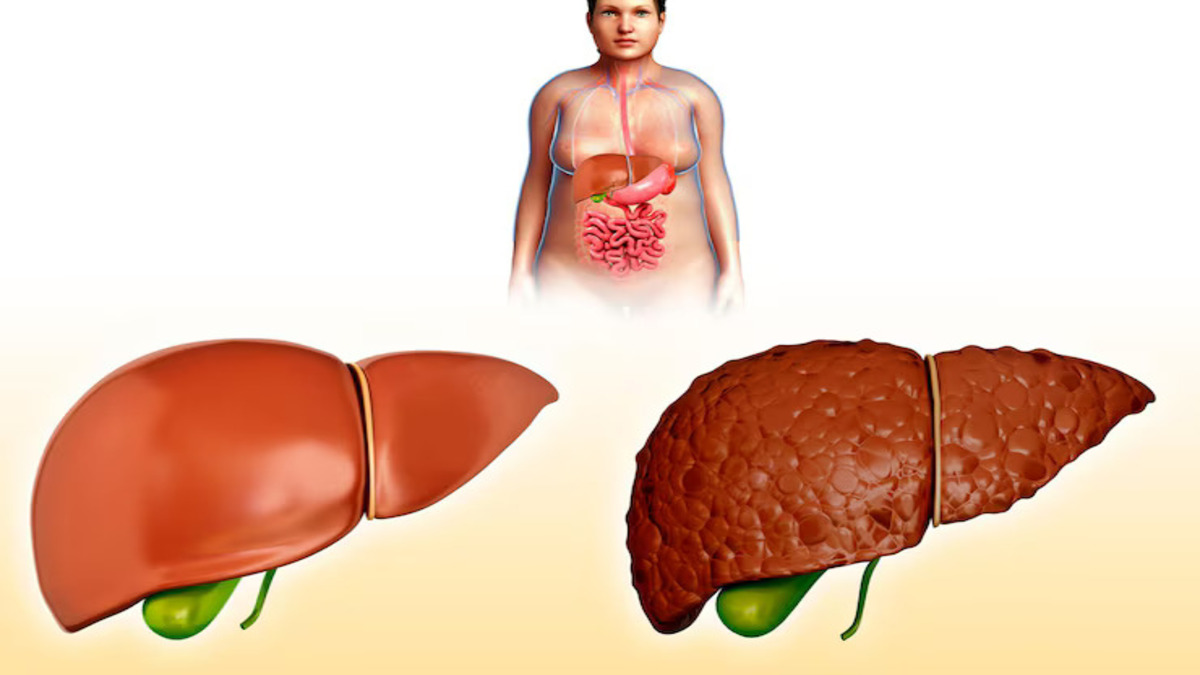 fatty-liver-juice-1749391435579
