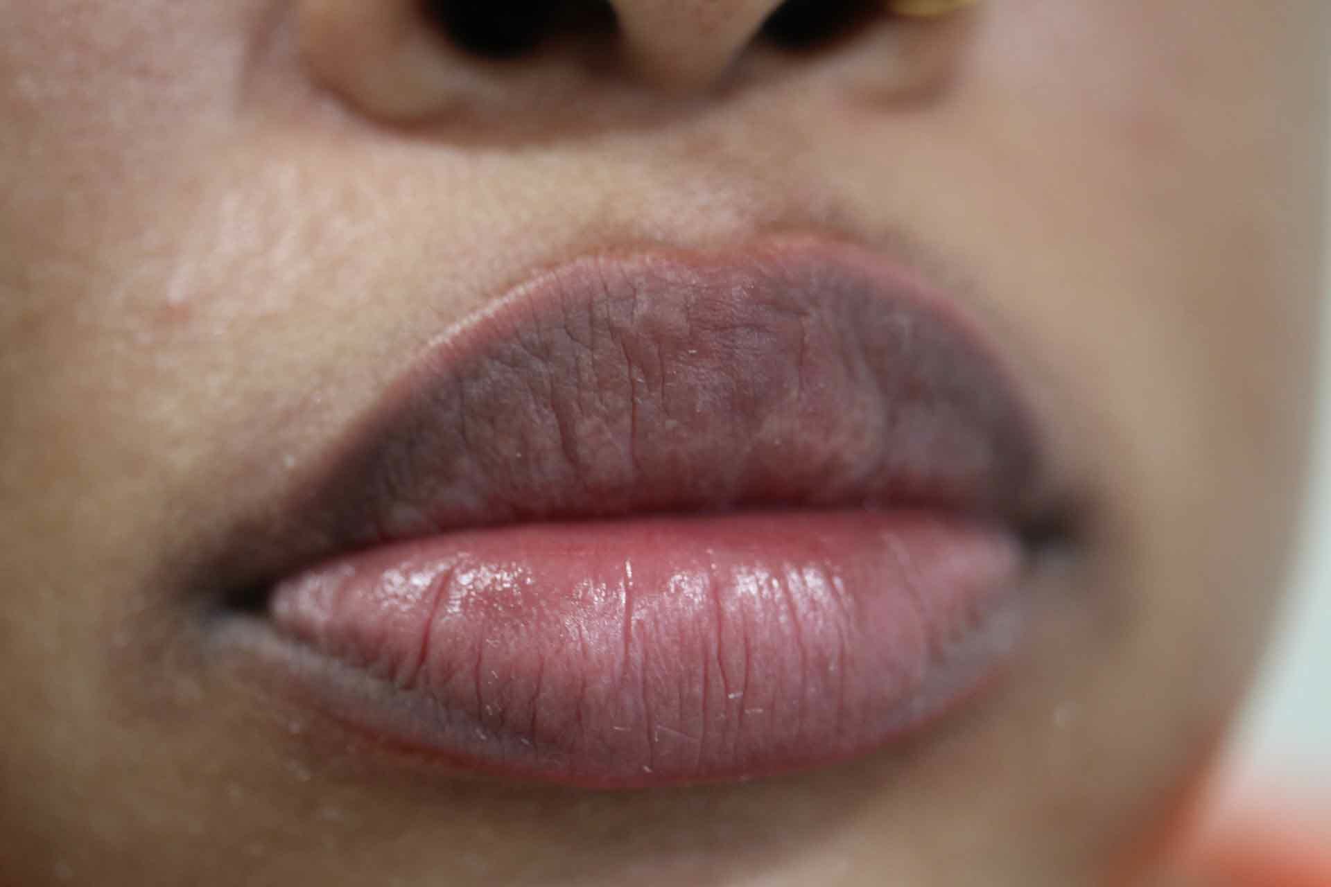 Lips-4-before
