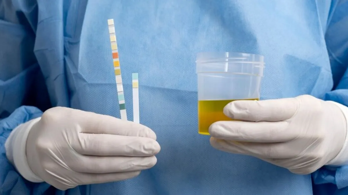 urine-colour-change--1739634808941 (1)