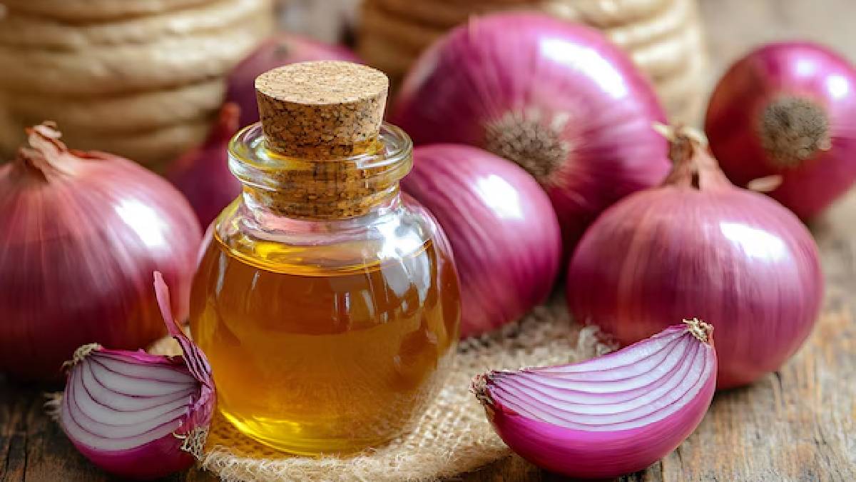 கூந்தல் வளர்ச்சியை அதிகரிக்கும் வெங்காய எண்ணெய்; உங்கள் வீட்டிலேயே ஈசியாக செய்யலாம்