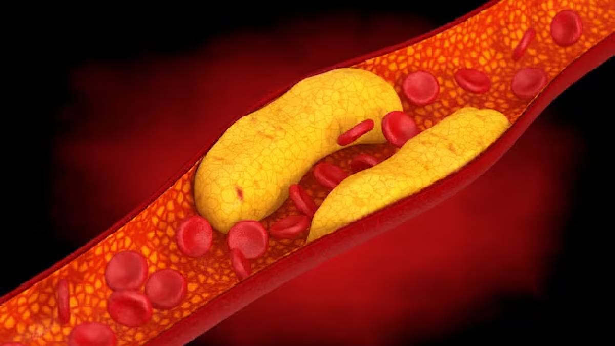 கொலஸ்ட்ரால் அளவைக் குறைக்க வேண்டுமா; இந்த உணவுகளை அவசியம் சாப்பிடவும்