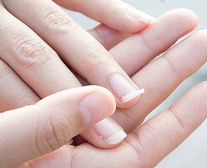 Home Remedies for Brittle Nails Coconut Oil Green Tea in Hindi HerZindagi