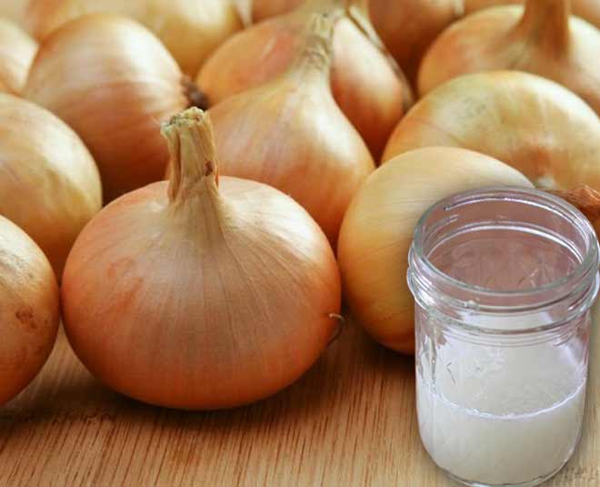 प्याज का जूस home remedies to cure heatstroke in summer inside