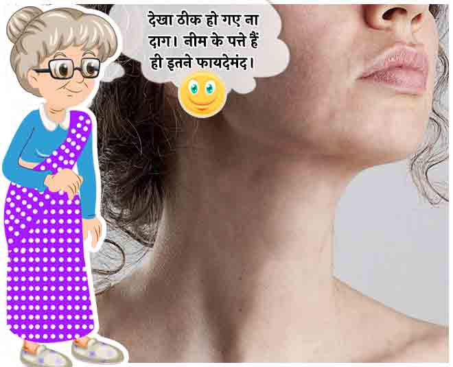 neem leaves to cure chicken pox in