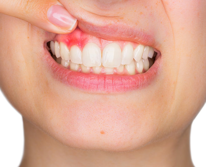 pregnancy dental care inside