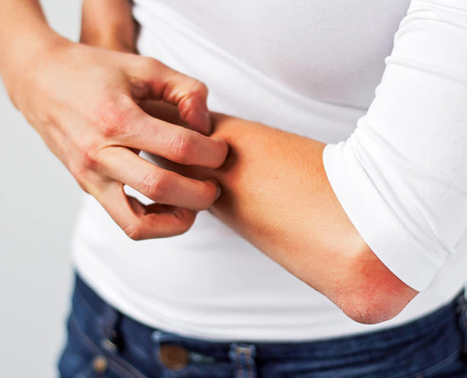 ringworm health inside