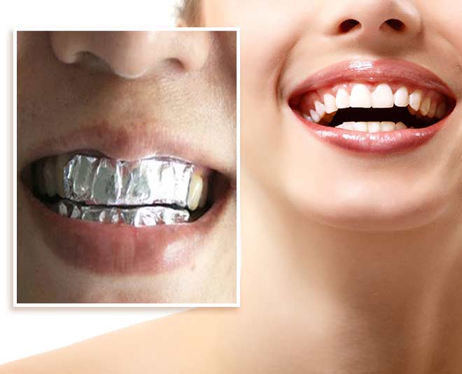 yellow and white teeth inside