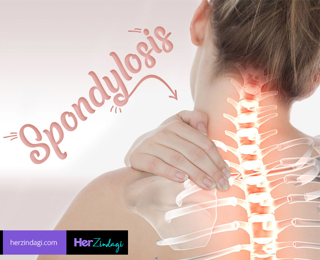 These 5 Things Can Help In Cervical Spondylosis | HerZindagi