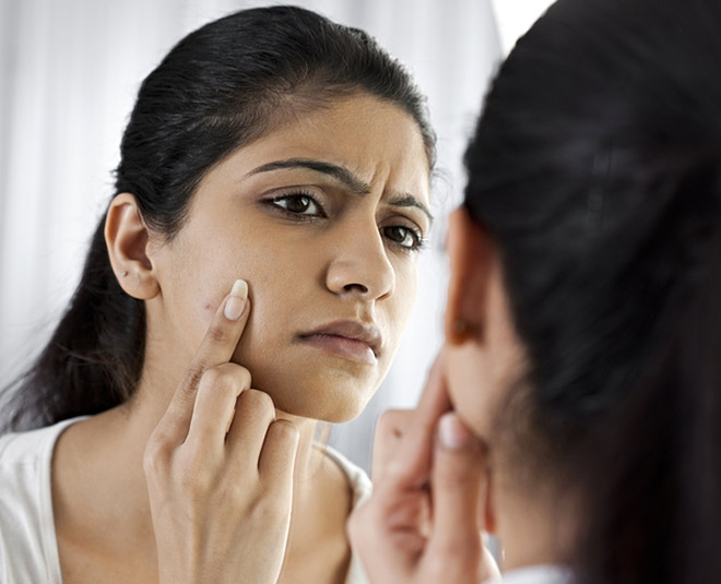 milia skin disease poke inside