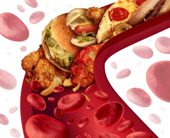 cholesterol and junk food