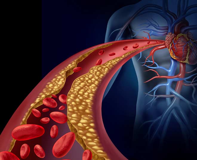 cholesterol level health
