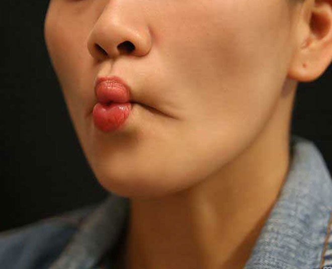 exercise for perfect pout fish mouth