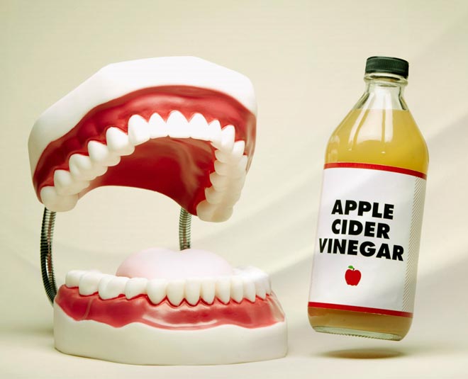 Apple Cider Vinegar रखेगा आपके दांतो को white tips to get white teeth article edited inside